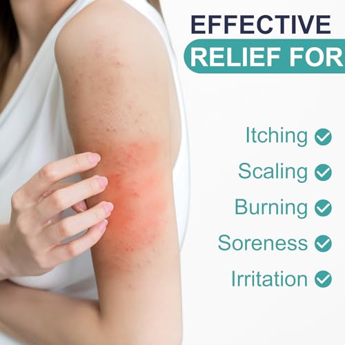 Antifungal Cream for Athlete’s Foot, Jock Itch - 1% Clotrimazole