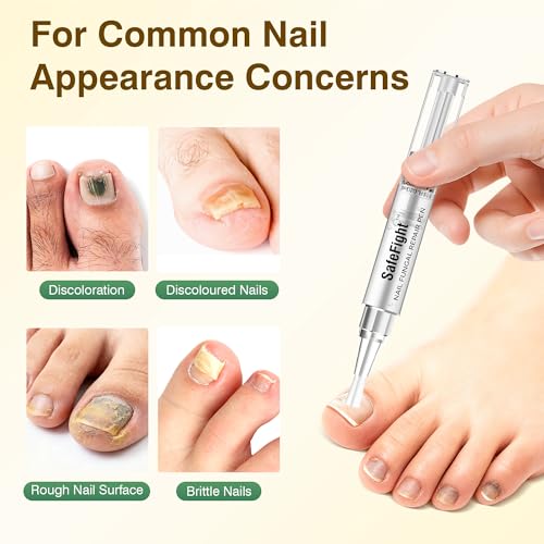 Toenail Fungus Treatment Extra Strength with 25% Undecylenic Acid for Damaged Nails, Nail Repair, 3PCS