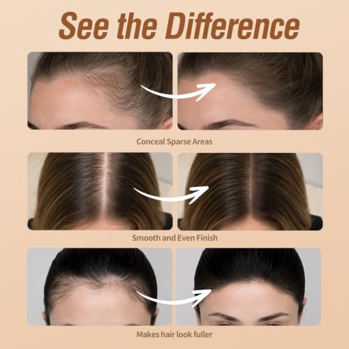 Sevich Hairline Powder 10g 2-Pack with Brush, Instantly Conceals Hair Loss & Thinning, 48H Waterproof Root Touch Up Powder, Natural Hair Shadow Toppers for Women & Men, 2 Box = 5 Boxes,Brown Brown 0.71 Ounce (Pack of 1)