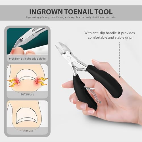 6Pcs Ingrown Toenail Removal Kit, Pedicure Tools for Feet with Fingernail & Toenail Clippers, Professional Nail Cutter Set for Thick Nails, Manicure & Nail Care Tools for Men & Women Black6