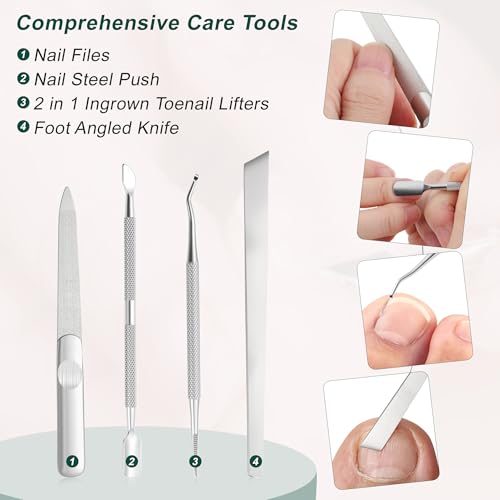 VOCOSTE 6Pcs Ingrown Toenail Kit