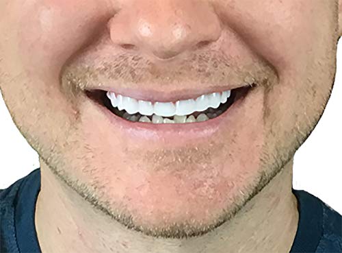 Instant Smile Flex 2pk - Bright White Shade - One Size Fits Most. Fix Your Smile At Home in Minutes! Comfortable Upper Cosmetic Veneer for A Perfect Smile! 1 Count (Pack of 2)