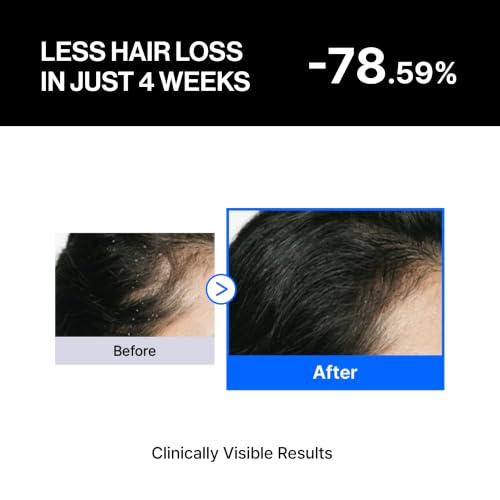 Refilled cADPR Booster Plus Hair Growth Serum for Moisturizing Scalp Care Moisture