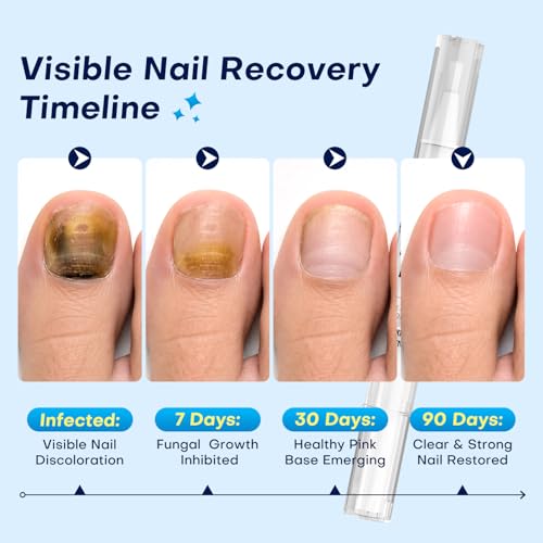Nail Fungus Treatment Pen for Damaged Nails-Contains 25% Undecenoic Acid, Tea Tree Oils, along with Other Natural Ingredients, Mild and Non-Toenail Fungus Treatment Extra Strength 4pcs