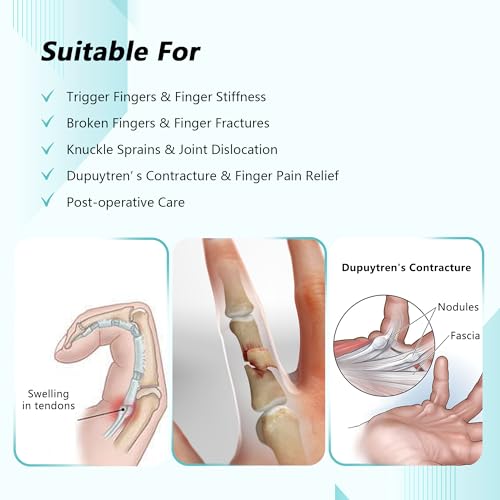 Trigger Finger Splint, Adjustable Two Finger Splint with Upgraded Wrist Strap, Full Hand and Wrist Brace Support, Metal Straightening Immobilizer for Sprains, Mallet Injury, Arthritis (S/M) S/M Upgraded Version