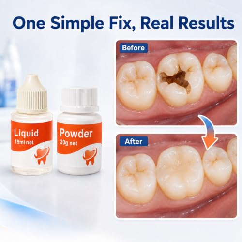 Dental Care Kit: Dental Cement Glue Adhesive for Crowns, Bridges, Teeth Dental Cement Glue Adhesive