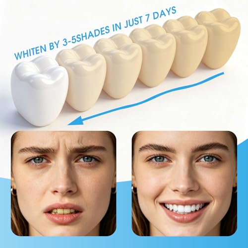 Teeth Whitening Light with Teeth Whitening Strips Kit