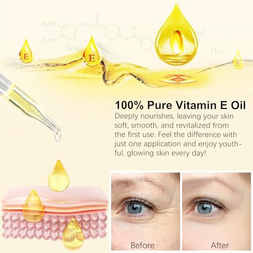 flasture Vitamin E Oil 75,000 IU – 100% Pure Natural Vitamin E for Skin, Face, Hair, Scars – Deep Moisturizing Body Oil for Dry Skin, Wrinkles – Cold-Pressed, Non-GMO,Skincare – 2 Fl Oz 2 Fl Oz (Pack of 1)