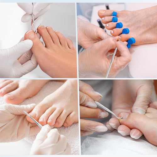 6PCS Ingrown Toenail File and Lifters, Ingrown Toenail Removal Kit Silver