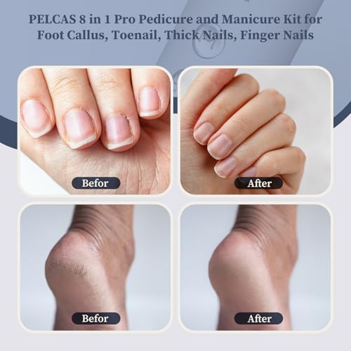 PELCAS Electric Nail Filer, Cordless Nail Drill with LED Light & 5 Speeds Silver