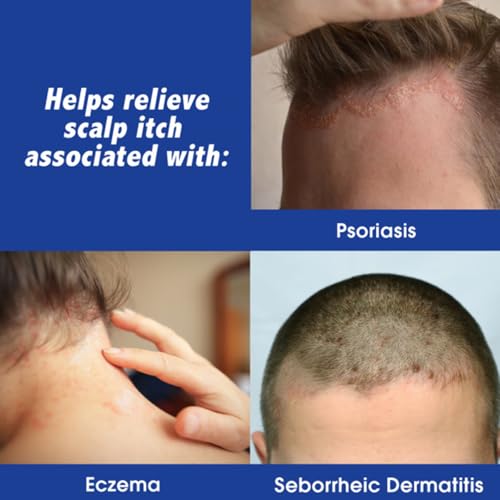 Scalpicin Maximum Strength Scalp Treatment Liquid for Itchy Scalp, Seborrheic Dermatitis & Psoriasis Scalp Treatment, Fragrance-Free, 1.5 fl oz 1.5 Ounce (Pack of 1)