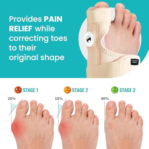 Promifun Bunion Corrector for Women & Men - 1 Pair Adjustable Toe Splint for Broken Toe - Pain Relief Support Brace & Straightener with Non-Slip Strap(Beige) Beige