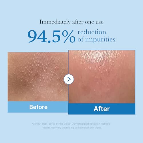 medicube Double Cleansing Duo - Zero Pore Cleansing Oil, Zero Foam Cleanser