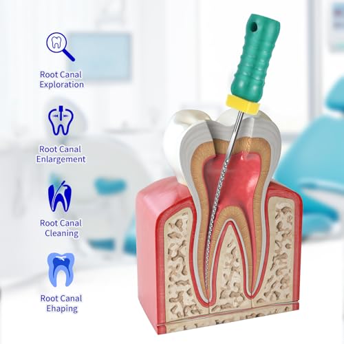 Annhua Endodontic Root Canal K Files 25MM Stainless Steel K-Files with Assorted Sizes, Sturdy Hand Use Dental Endodontic Endo K Files for Treatment, 15-40# | 6 Pcs MIX-15~40#