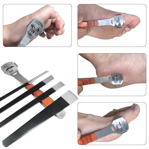 36 Pcs Callus Shaver for Feet Set, Foot Callus Shaver, (1 Stainless Foot File &1 Foot File Heads & 4 Pedicure Knife & 30 Replacement Slices Blades) B-set