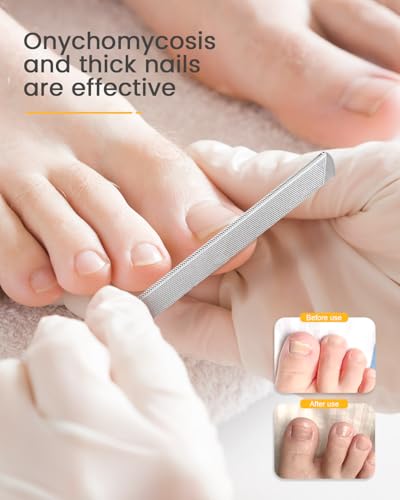 BEZOX Long Metal Nail File, Stainless Steel Fingernail File for Thick and Fungal Nails with Dual-Ended Toenail Lifter – The Ultimate Manicure & Pedicure Tool for Men and Women’s Nail Care - Black 80/100 Grit 2.0