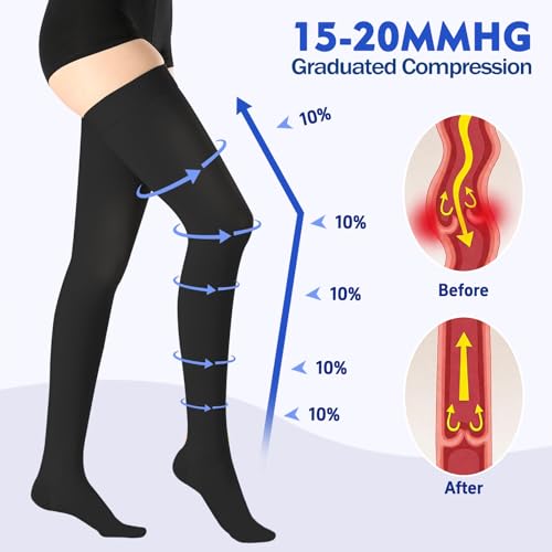 Thigh High Medical Compression Stockings For Women & Men,15-20 mmHg Thigh High Compression Socks,Firm Graduated Support Hose with Silicone Dot Band-Ideal for DVT,Varicose Veins,Edema,Swelling Small Closed Toe Black