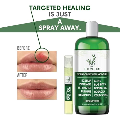 All Natural Eczema Treatment- Psoriasis Treatment - an All-in-One Solution for Acne, Dermatitis, Rosacea, Cold Sores, Pet Rashes, Bug Bites, and Poison Ivy - Anti-Itch Spray for Itchy Skin Relief Original 2 Piece Set (8 Fl Oz total)