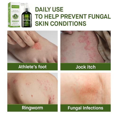 Roycederm Clotrimazole 1% Antifungal Spray for Athlete's Foot, 4.05 fl oz Tea Tree Oil Spray 1 Pack