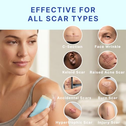 Suquato Silicone Scar Stick – Silicone Keloid Scar Removal Cream for Face & Body, Helps Improve Surgical Scars, C-Section, Acne Scars & Stretch Marks, Portable Twist Stick– 20g
