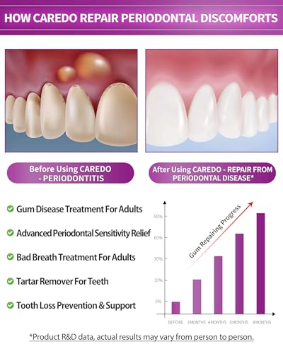 CAREDO New Taste Gum Repair Toothpaste for Adults, Fluoride Free Periodontal Treatment for Receding Gums, Recession Bleeding Periodontitis, Reverse Gingivitis, Plaque Control & Bad Breath 3.52 OZ