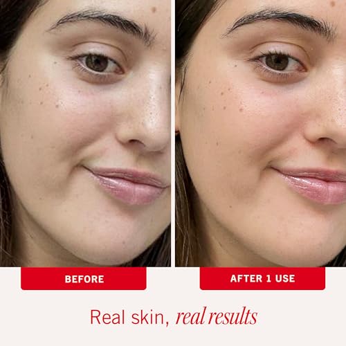First Aid Beauty - Ultra Repair Face Moisturizer, Soothing Face Colloidal Oatmeal, Non-Comedogenic Formula Helps Soften Skin with Ceramides and Shea Butter New