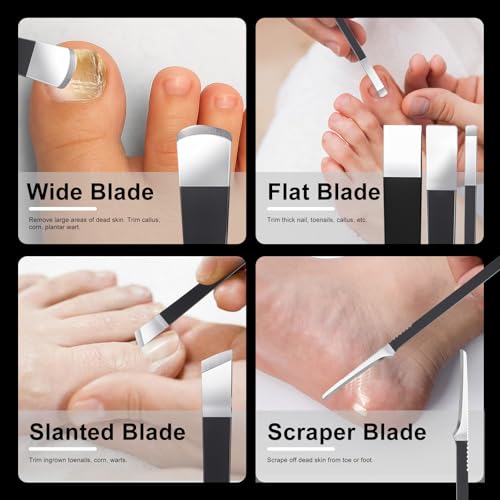 7 Pcs Professional Pedicure Tools for Feet, Stainless Steel Ingrown Toenail Removal Blade Kit with File, Toe Nail Knife Set for Men Women,Corn and Rasp Callus Remover Foot Scraper for Dead Skin