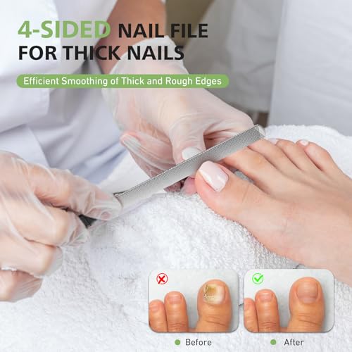 BALUCA Toenail File for Thick Nails & Ingrown Relief | Heavy Duty Metal Emery Board with Toenail Lifter for Seniors, Coarse Grit & Durable Stainless Steel Design (Black, 1.0, Count, 180/240 Grit) Black