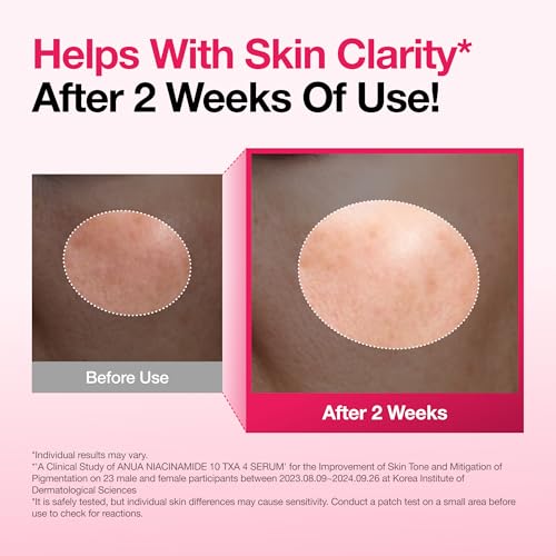 Anua Niacinamide 10 + TXA 4 Serum, Korean Skincare, 1.01 fl.oz | Dark Spot Care, Hyaluronic Acid, Tranexamic Acid, Lightweight & Hydrating All-in-One Daily Facial Serum for Glass Skin 1.01 Fl Oz (Pack of 1)