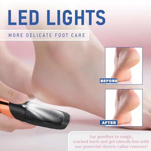 LQT® Electric Foot File – Rechargeable Callus Remover for Hard, Cracked Skin – At-Home Pedicure Kit for Smooth Feet (Men & Women) (Black) Black