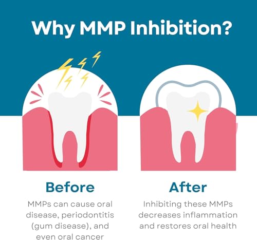 Fluoride-Free Nano-Hydroxyapatite Toothpaste – Whitening, Sensitive Teeth, MMP Inhibiting, Antiplaque, Remineralizing, Created by Doctors + Dentists for Gum Health, SLS-Free, Made in USA, 4oz, 3-Pack