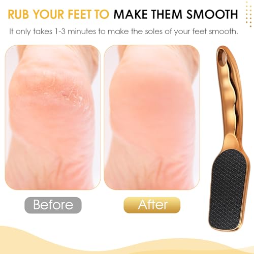 Nano-Glass Foot File Gold, Ergonomic Handle Foot Care Tool