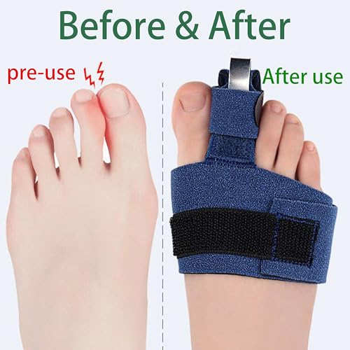 Hammer Toe Straightener and Corrector Kit - Toe Splint for Women and Men with Toe Straps, Compression Foot Wrap, Straighteners for Curled Toes, and Broken Toe Support.