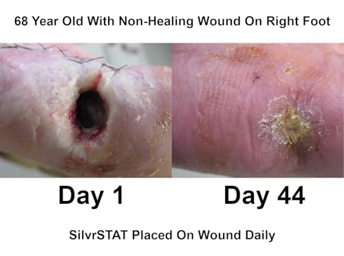 SilvrSTAT First Aid Kit Gel, 32 PPM Silver Healing Wound Dressing Solution, SilverSol Ag₄O₄ Particles, 3 oz 3 Ounce