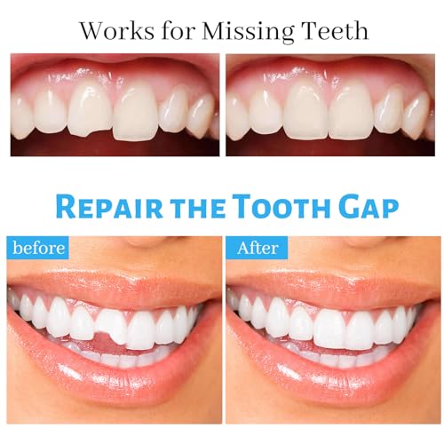 Tooth Repair Kit, Fake Teeth Replacement Kit - Moldable Thermal Fitting Beads for Filling Fix Missing and Broken Tooth or Adhesive Denture Fake Teeth