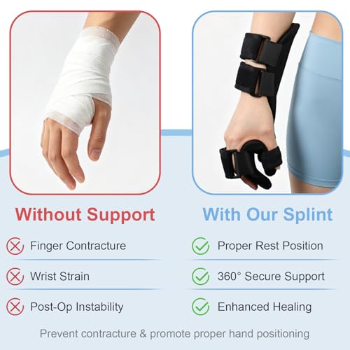 Resting Hand Splint Left & Right – Adjustable Night Wrist Brace with Finger Separators for Carpal Tunnel, Arthritis, Tendonitis, Post-Injury Recovery – Breathable Hand Support for Straightening Fingers (Large Left) Large Left