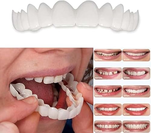 Unisex Temporary Cosmetic Smile, Natural Look, 2 Pairs