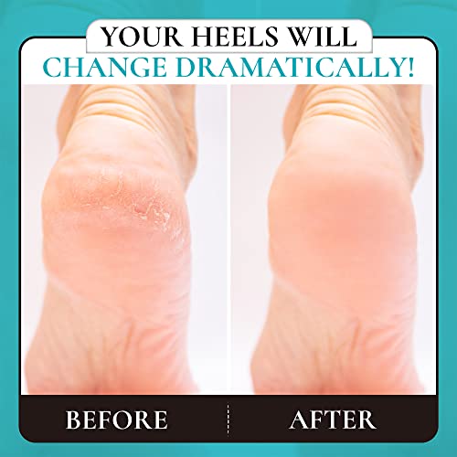 Foot rasp Pedicure Foot File - Removes Damaged and Hard Skin, Avoids Callus Buildup – Gentle, Fine File for At-Home Professional Treatment (Black, Waterproof, Comes with Original Pouch)
