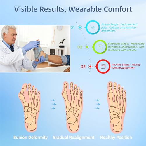 Bunion Corrector for Women & Men, Adjustable Big Toe Straightener