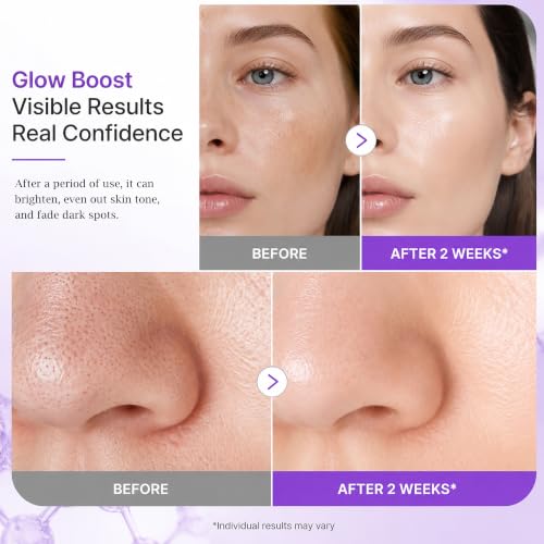 NAD+PDRN Glow Brightening Toner, NAD+PDRN Face Toner, Deeply moisturizes and brightens the Skin, Hydrating Facial Toner for All Skin Types, 5.07 FL OZ, 1 PCS 1pcs 5.07 Fl Oz (Pack of 1)