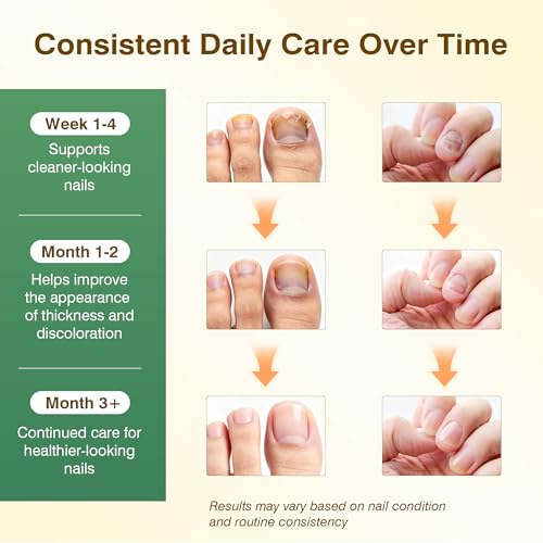 Toenail Fungus Treatment Extra Strength with 25% Undecylenic Acid for Damaged Nails, Nail Repair, 3PCS