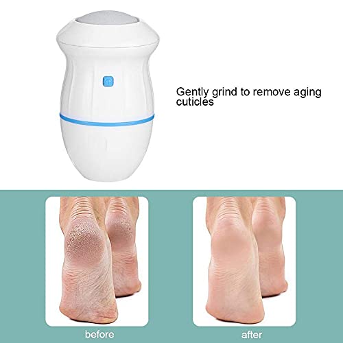 Electric Feet Callus Remover, Battery Operated Foot Grinder Callus Dead Skin Remover Vacuum Foot File Pedicure Tool(White + Blue) - BeesActive Australia