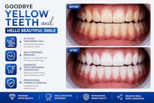Professional Teeth Whitening Gel 44% Hydrogen Peroxide – LaserGlow in-Office Formula | Dual Barrel Auto-Mix Syringe | for Salons, Medspas & Whitening Technicians | 5mL