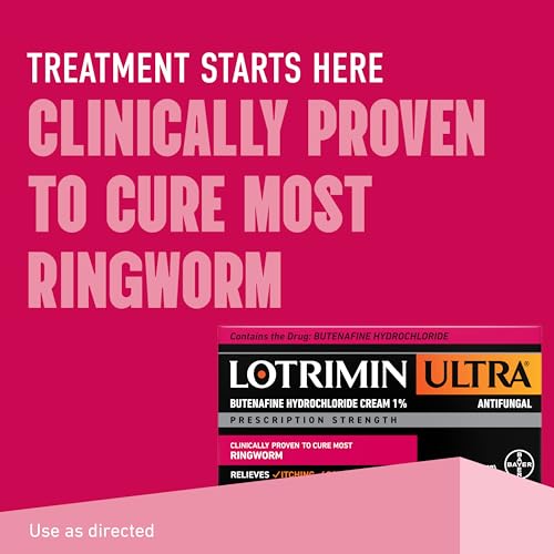Lotrimin Ultra Ringworm Cream, Butenafine Hydrochloride 1%, Effective Antifungal Treatment of Most Ringworm, 1.1 Ounce (30 Grams) 30g