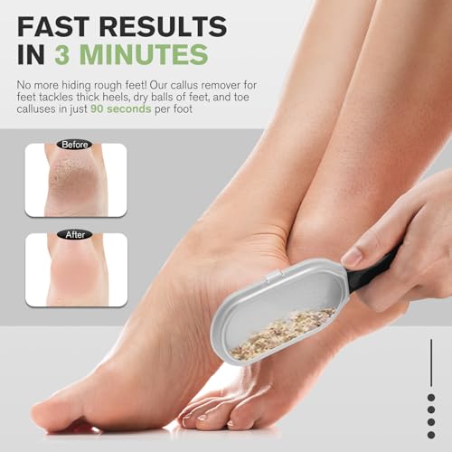 FERYES Foot File Callus Remover with Dead Skin Catcher – The Genius Foot Scrubber for Mess-Free Pedicures, Heel Scraper for Cracked Heel Treatment, Wet & Dry Use Feet Rasp - Black Stainless Steels with Catcher