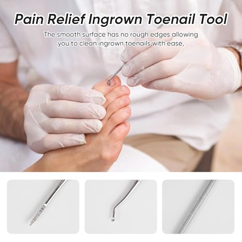 6PCS Ingrown Toenail File and Lifters, Ingrown Toenail Removal Kit Silver