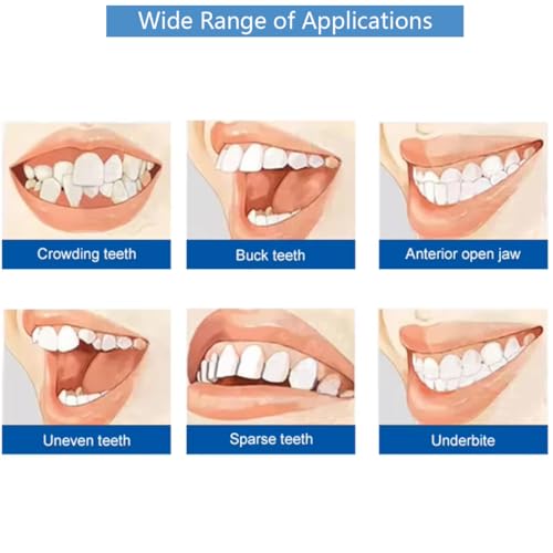 Dental Orthodontic Self-Ligating Metal Bracket Passive Dental Metal Braces with Open Tools Slot (ROTH 022 3 with HOOKS) ROTH 022 3 with HOOKS