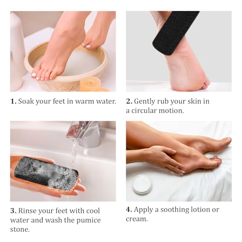 Foot File with Handle Pumice Stone for Dry Dead Skin - Callus Remover for Feet Double-Sided Foot File for Callus, Cracked Heels, Dead, and Dry Skin Removal