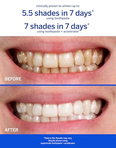 Supersmile Professional Whitening Toothpaste w/Fluoride - Removes Stains & Whitens Teeth 6 Shades - Enamel Strengthening - No Sensitivity - Travel Size (Original Mint, 1.4 Oz) (Pack of 2) 1.4 Ounce (Pack of 2)