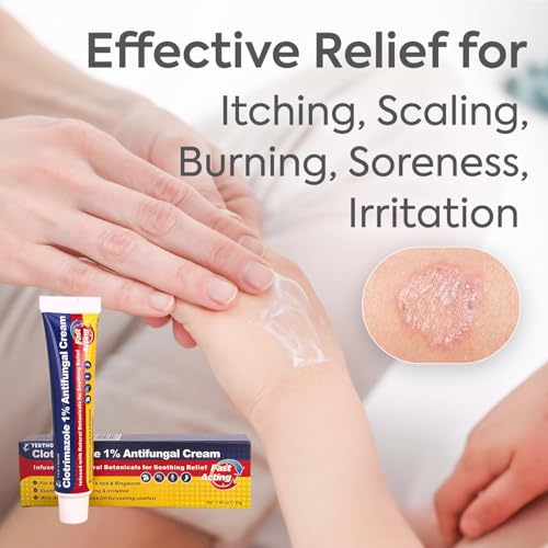 Clotrimazole Antifungal Treatment Cream 30g (1 Pack)